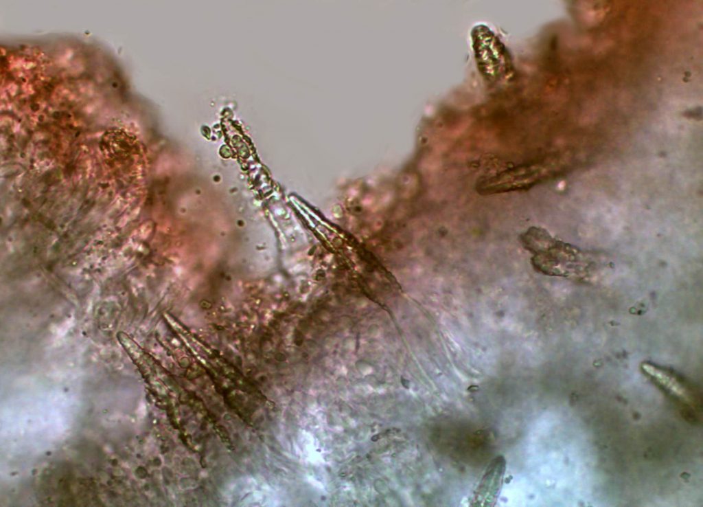 LAMPRO phlebiopsis